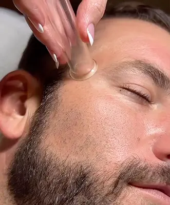 Man receiving HydraFacial Lymphatic Drainage facial treatment at LA West Hollywood skincare clinic