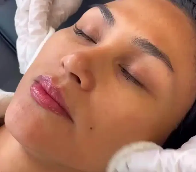 Women receiving a deep cleansing and exfoliating HydraFacial treatment