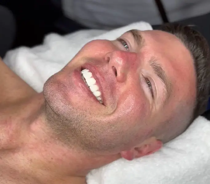 Man treated with HydraFacial MD plump skin treatment